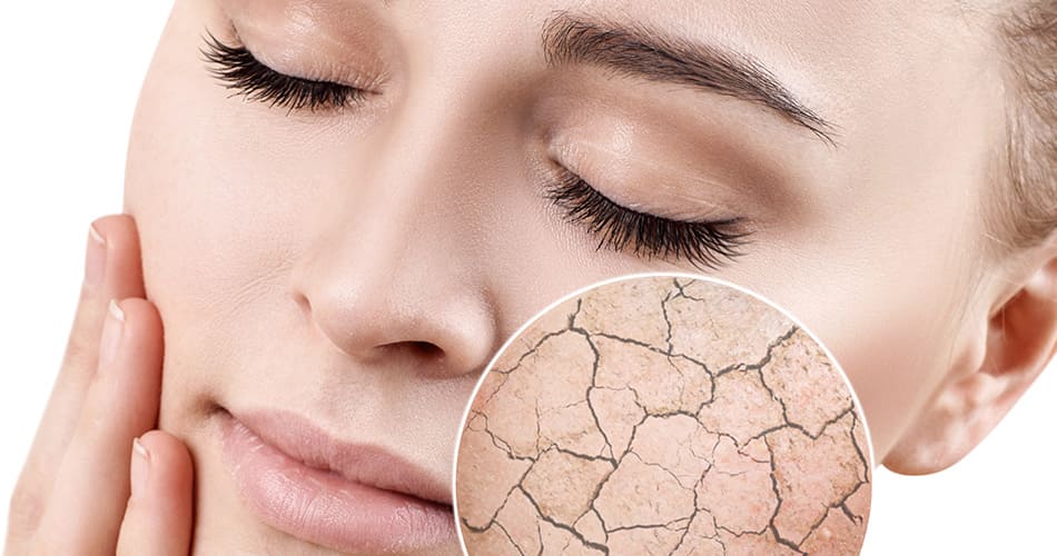 femme avec une peau seche quel masque adapté