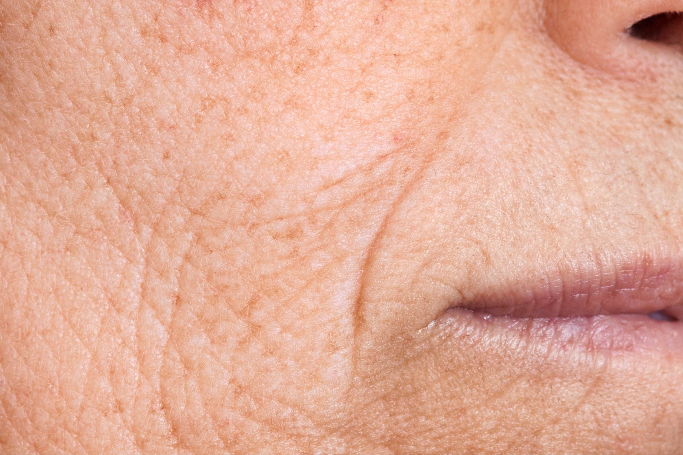 peaux matures quel masque collagene