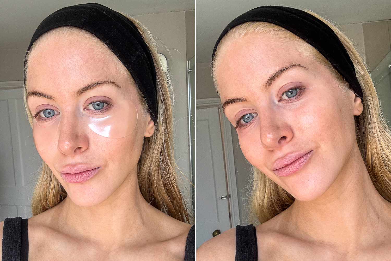 avant après patches femmes yeux